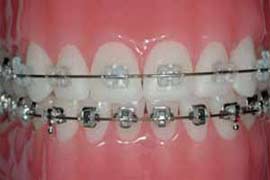 sanjeevanidentalcare