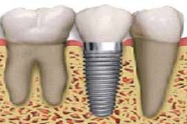 sanjeevanidentalcare